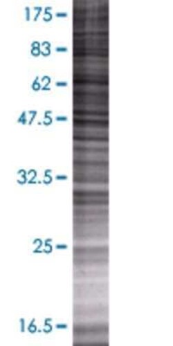Novus Biologicals SP140 293T Cell Transient Overexpression Lysate 0.1 mL | Buy Online | Novus Biologicals&trade; | Fisher Scientific