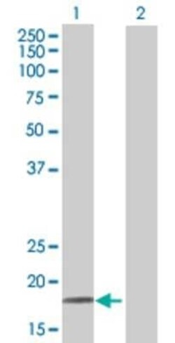 Novus Biologicals SP140 293T Cell Transient Overexpression Lysate 0.1 mL | Buy Online | Novus Biologicals&trade; | Fisher Scientific