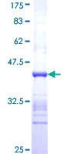 Novus Biologicals Recombinant Human DUSP12 GST (N-Term) Protein 25 &mu;g | Buy Online | Novus Biologicals&trade; | Fisher Scientific