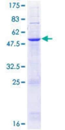Novus Biologicals&trade;&nbsp;Recombinant Human Nurim GST (N-Term) Protein