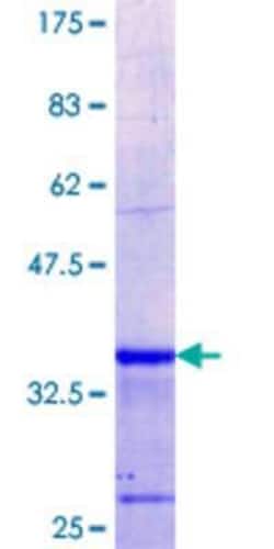 Novus Biologicals Recombinant Human KLHL2 GST (N-Term) Protein 10 &mu;g | Buy Online | Novus Biologicals&trade; | Fisher Scientific