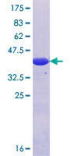 Novus Biologicals Recombinant Human AP1GBP1 GST (N-Term) Protein 25 &mu;g | Buy Online | Novus Biologicals&trade; | Fisher Scientific