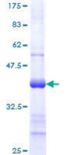 Novus Biologicals Recombinant Human TREX1 GST (N-Term) Protein 25 &mu;g | Buy Online | Novus Biologicals&trade; | Fisher Scientific