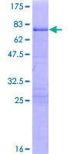 Novus Biologicals Recombinant Human KLF8 GST (N-Term) Protein 10 &mu;g | Buy Online | Novus Biologicals&trade; | Fisher Scientific