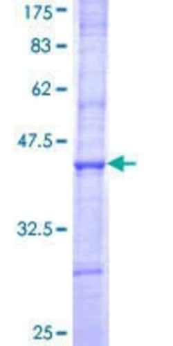 Novus Biologicals Recombinant Human MGAT4B GST (N-Term) Protein 10 &mu;g | Buy Online | Novus Biologicals&trade; | Fisher Scientific