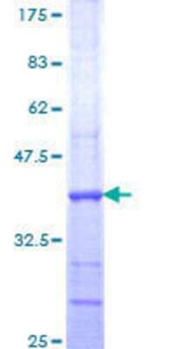 Novus Biologicals Recombinant Human PNK GST (N-Term) Protein 10 &mu;g | Buy Online | Novus Biologicals&trade; | Fisher Scientific