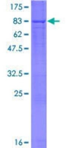 Novus Biologicals Recombinant Human RBPSUHL GST (N-Term) Protein 10 &mu;g | Buy Online | Novus Biologicals&trade; | Fisher Scientific