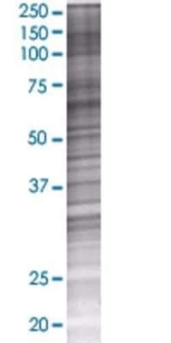 Novus Biologicals&trade;&nbsp;RBPSUHL 293T Cell Transient Overexpression Lysate