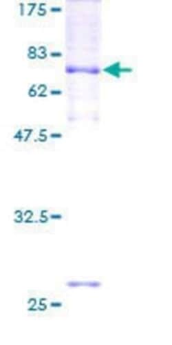 Novus Biologicals Recombinant Human TMC6 GST (N-Term) Protein 2 &mu;g | Buy Online | Novus Biologicals&trade; | Fisher Scientific