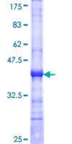 Novus Biologicals Recombinant Human STK38 GST (N-Term) Protein 25 &mu;g | Buy Online | Novus Biologicals&trade; | Fisher Scientific
