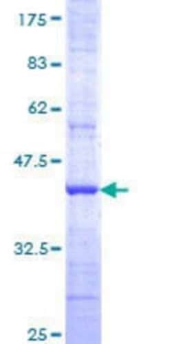 Novus Biologicals Recombinant Human SEC6 GST (N-Term) Protein 25 &mu;g | Buy Online | Novus Biologicals&trade; | Fisher Scientific