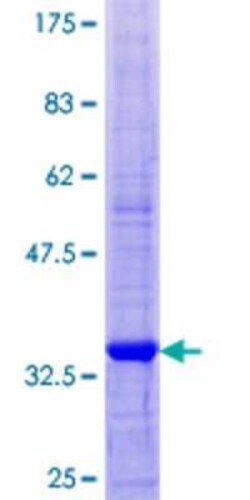 Novus Biologicals Recombinant Human SCRG1 GST (N-Term) Protein 25 &mu;g | Buy Online | Novus Biologicals&trade; | Fisher Scientific