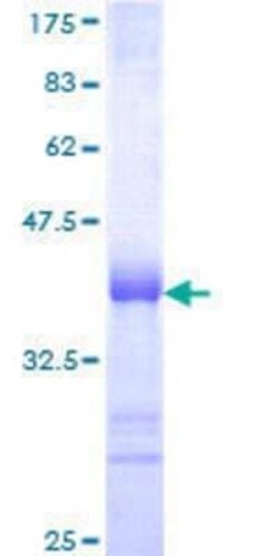 Novus Biologicals Recombinant Human RNF13 GST (N-Term) Protein 25 &mu;g | Buy Online | Novus Biologicals&trade; | Fisher Scientific