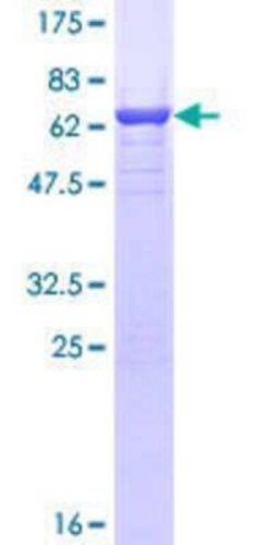 Novus Biologicals Recombinant Human TWF2 GST (N-Term) Protein 10 &mu;g | Buy Online | Novus Biologicals&trade; | Fisher Scientific