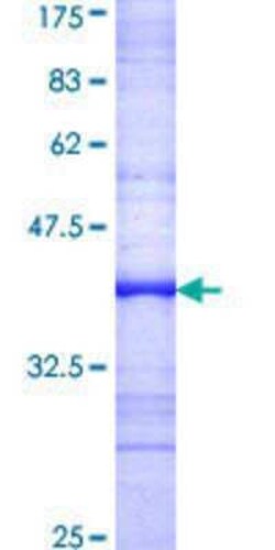 Novus Biologicals Recombinant Human TWF2 GST (N-Term) Protein 10 &mu;g | Buy Online | Novus Biologicals&trade; | Fisher Scientific