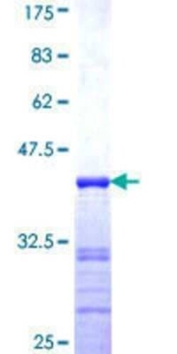 Novus Biologicals Recombinant Human CASC3 GST (N-Term) Protein 10 &mu;g | Buy Online | Novus Biologicals&trade; | Fisher Scientific