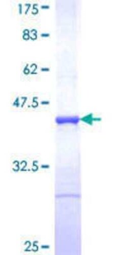 Novus Biologicals Recombinant Human COG2 GST (N-Term) Protein 2 &mu;g | Buy Online | Novus Biologicals&trade; | Fisher Scientific