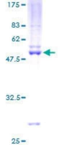 Novus Biologicals Recombinant Human TFEC GST (N-Term) Protein 25 &mu;g | Buy Online | Novus Biologicals&trade; | Fisher Scientific