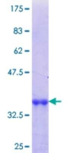 Novus Biologicals Recombinant Human TFEC GST (N-Term) Protein 25 &mu;g | Buy Online | Novus Biologicals&trade; | Fisher Scientific