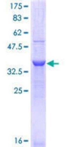 Novus Biologicals Recombinant Human Integrin alpha 11 GST (N-Term) Protein 25 &mu;g | Buy Online | Novus Biologicals&trade; | Fisher Scientific