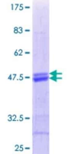 Novus Biologicals Recombinant Human ATF5 GST (N-Term) Protein 25 &mu;g | Buy Online | Novus Biologicals&trade; | Fisher Scientific