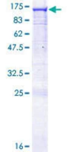 Novus Biologicals Recombinant Human RASA3 GST (N-Term) Protein 25 &mu;g | Buy Online | Novus Biologicals&trade; | Fisher Scientific