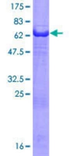 Novus Biologicals Recombinant Human PHLDA1 GST (N-Term) Protein 10 &mu;g | Buy Online | Novus Biologicals&trade; | Fisher Scientific