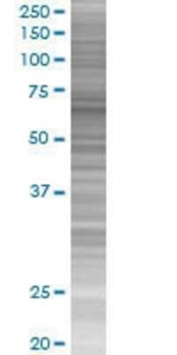 Novus Biologicals MTF2 293T Cell Transient Overexpression Lysate 0.1 mL | Buy Online | Novus Biologicals&trade; | Fisher Scientific