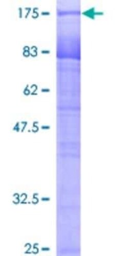 Novus Biologicals Recombinant Human PUF60 GST (N-Term) Protein 10 &mu;g | Buy Online | Novus Biologicals&trade; | Fisher Scientific