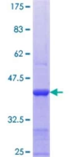 Novus Biologicals Recombinant Human PUF60 GST (N-Term) Protein 25 &mu;g | Buy Online | Novus Biologicals&trade; | Fisher Scientific