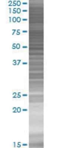 Novus Biologicals DLGAP4 293T Cell Transient Overexpression Lysate 0.1 mL | Buy Online | Novus Biologicals&trade; | Fisher Scientific
