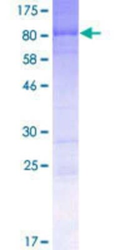 Novus Biologicals Recombinant Human RAB11FIP2 GST (N-Term) Protein 2 &mu;g | Buy Online | Novus Biologicals&trade; | Fisher Scientific