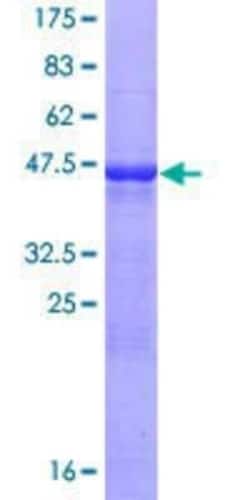 Novus Biologicals Recombinant Human Vasohibin GST (N-Term) Protein 10 &mu;g | Buy Online | Novus Biologicals&trade; | Fisher Scientific