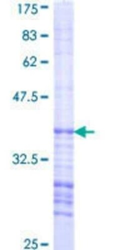Novus Biologicals Recombinant Human AAK1 GST (N-Term) Protein 25 &mu;g | Buy Online | Novus Biologicals&trade; | Fisher Scientific