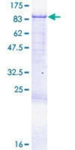 Novus Biologicals Recombinant Human CPEB3 GST (N-Term) Protein 2 &mu;g | Buy Online | Novus Biologicals&trade; | Fisher Scientific