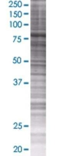 Novus Biologicals CPEB3 293T Cell Transient Overexpression Lysate 0.1 mL | Buy Online | Novus Biologicals&trade; | Fisher Scientific