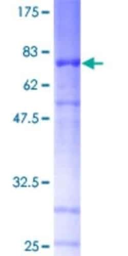 Novus Biologicals Recombinant Human NTNG1 GST (N-Term) Protein 25 &mu;g | Buy Online | Novus Biologicals&trade; | Fisher Scientific