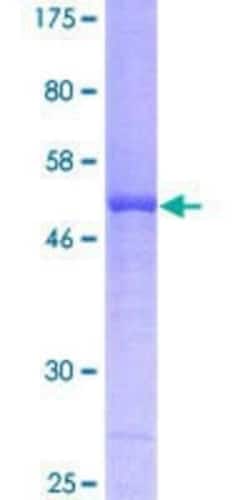 Novus Biologicals Recombinant Human ICK GST (N-Term) Protein 25 &mu;g | Buy Online | Novus Biologicals&trade; | Fisher Scientific