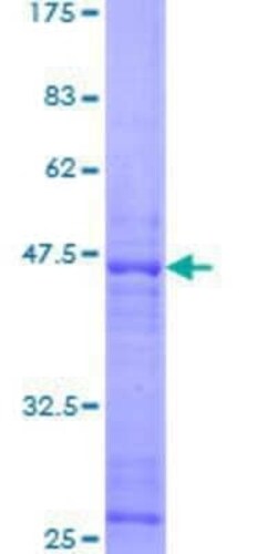 Novus Biologicals Recombinant Human Latrophilin 1/LPHN1 GST (N-Term) Protein 25 &mu;g | Buy Online | Novus Biologicals&trade; | Fisher Scientific