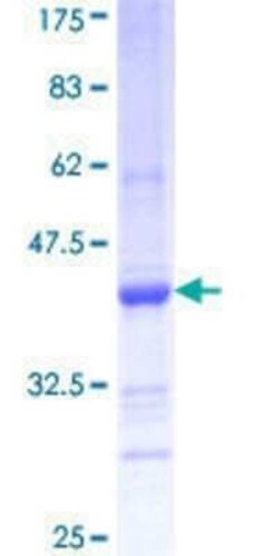 Novus Biologicals Recombinant Human FNDC3A GST (N-Term) Protein 10 &mu;g | Buy Online | Novus Biologicals&trade; | Fisher Scientific