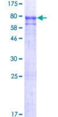 Novus Biologicals Recombinant Human SEC31A GST (N-Term) Protein 25 &mu;g | Buy Online | Novus Biologicals&trade; | Fisher Scientific