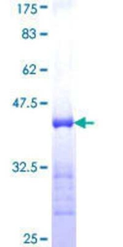 Novus Biologicals Recombinant Human DZIP1 GST (N-Term) Protein 25 &mu;g | Buy Online | Novus Biologicals&trade; | Fisher Scientific