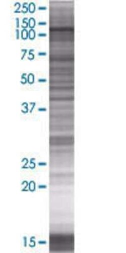 Novus Biologicals&trade;&nbsp;DZIP1 293T Cell Transient Overexpression Lysate
