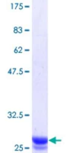Novus Biologicals Recombinant Human PEPP3 GST (N-Term) Protein 25 &mu;g | Buy Online | Novus Biologicals&trade; | Fisher Scientific
