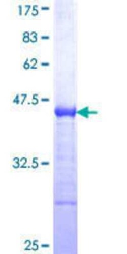 Novus Biologicals Recombinant Human ZHX2 GST (N-Term) Protein 25 &mu;g | Buy Online | Novus Biologicals&trade; | Fisher Scientific