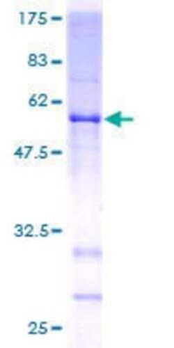 Novus Biologicals Recombinant Human WDR37 GST (N-Term) Protein 2 &mu;g | Buy Online | Novus Biologicals&trade; | Fisher Scientific
