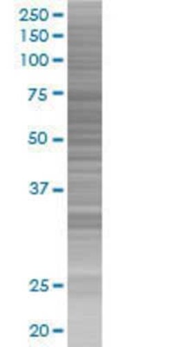 Novus Biologicals ABLIM3 293T Cell Transient Overexpression Lysate 0.1 mL | Buy Online | Novus Biologicals&trade; | Fisher Scientific