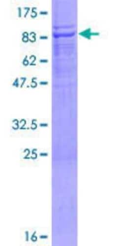 Novus Biologicals Recombinant Human UBOX5 GST (N-Term) Protein 25 &mu;g | Buy Online | Novus Biologicals&trade; | Fisher Scientific