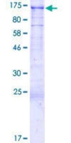 Novus Biologicals Recombinant Human BAHD1 GST (N-Term) Protein 2 &mu;g | Buy Online | Novus Biologicals&trade; | Fisher Scientific