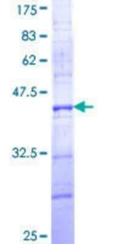 Novus Biologicals Recombinant Human CARD8 GST (N-Term) Protein 10 &mu;g | Buy Online | Novus Biologicals&trade; | Fisher Scientific